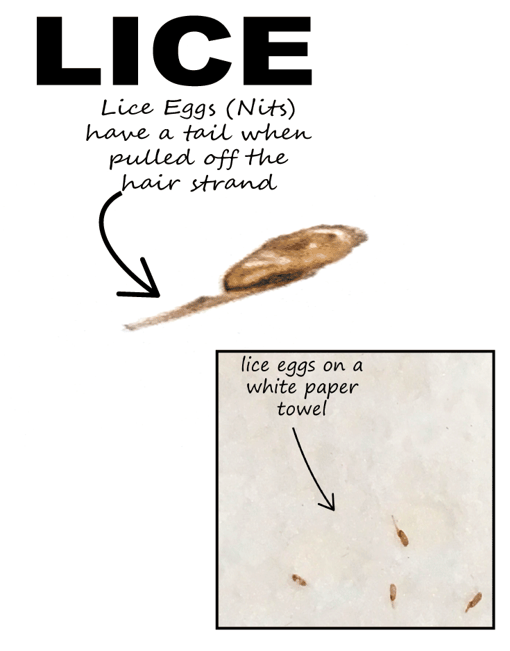 Lice egg (nit) with an arrow pointing to lice egg glue that looks like a tail and lice eggs on a white paper towel