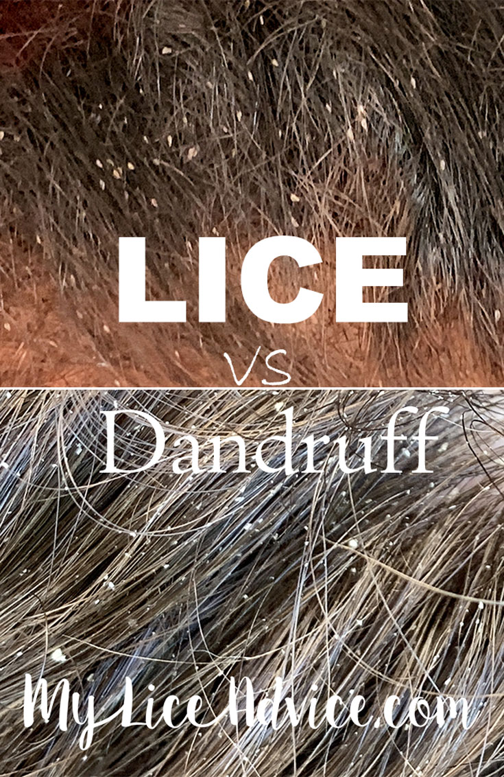 Identify My Lice Advice
