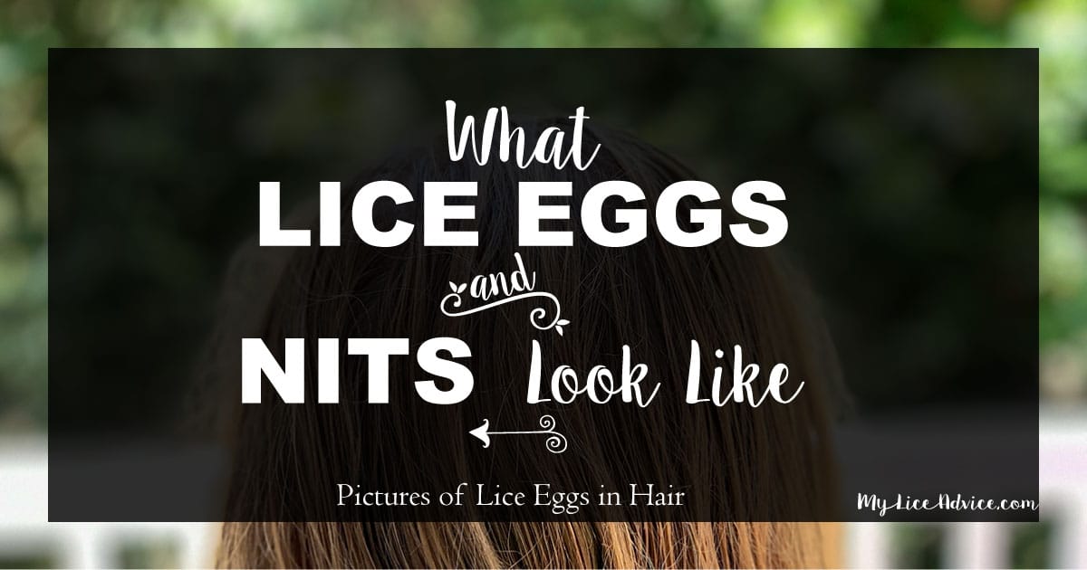 Pictures Of What Lice Eggs Nits Look Like In Hair 9 Tips To