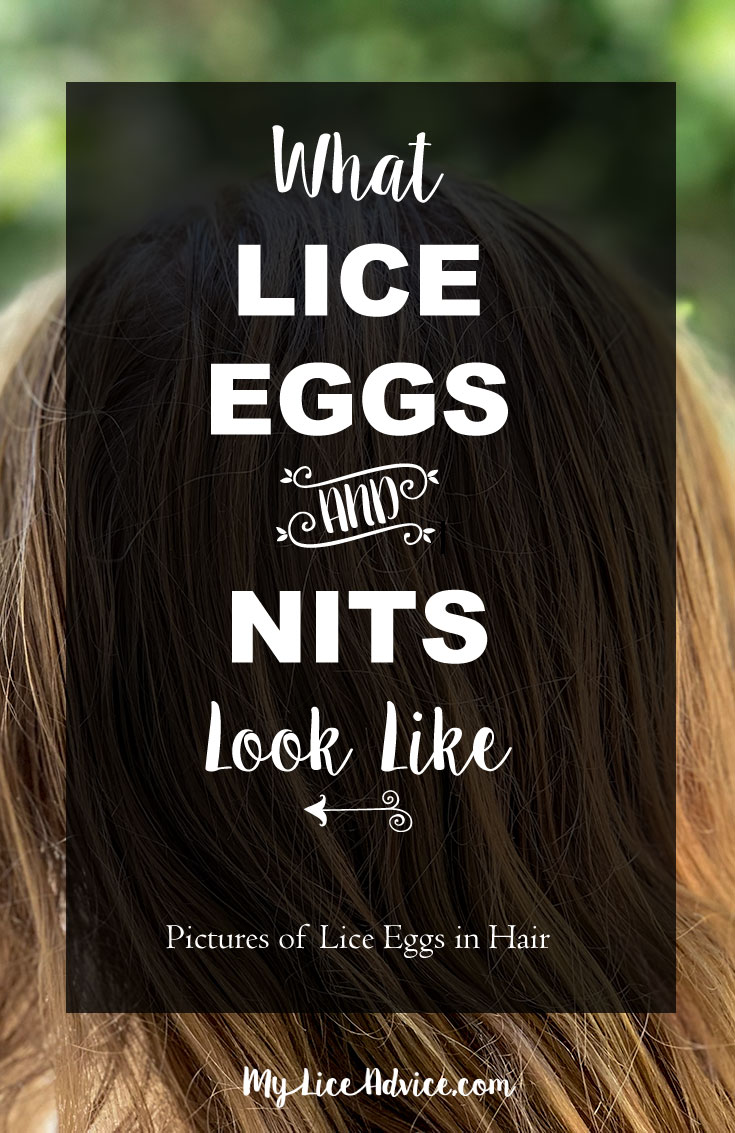 The title "What Lice Eggs and Nits Look Like" is in cursive writing against a girls hair in the background