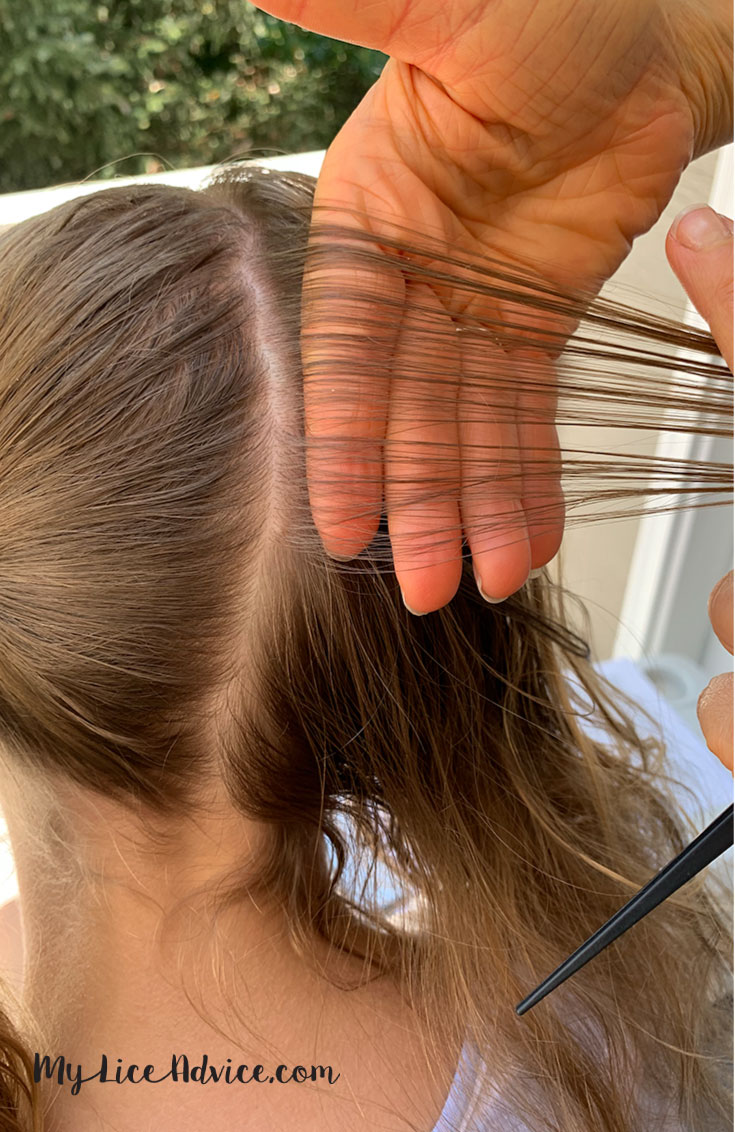 How To Check Your Child S Head For Lice Simple Steps With Pictures