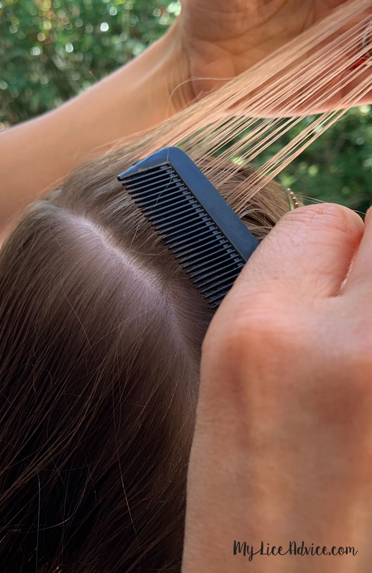 How To Check Your Child S Head For Lice Simple Steps With Pictures