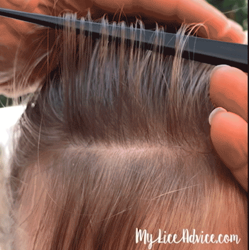 lice check sections