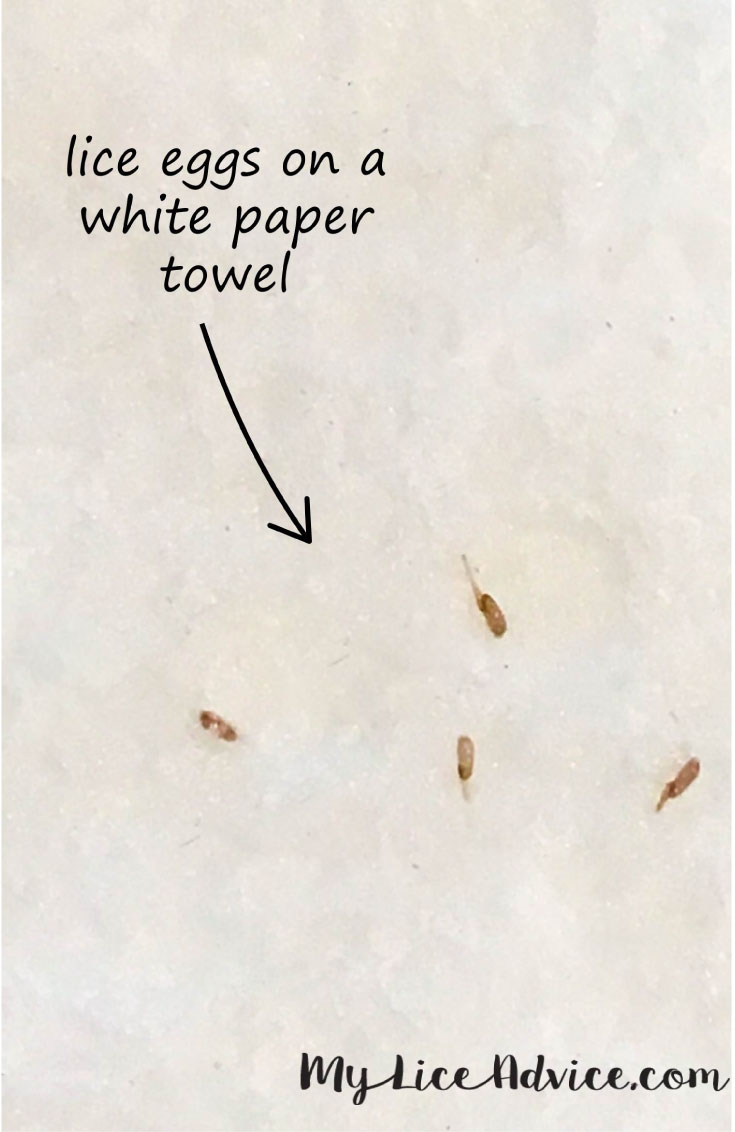 Four tear-dropped, golden-brown lice eggs (nits) are shown on a paper towel