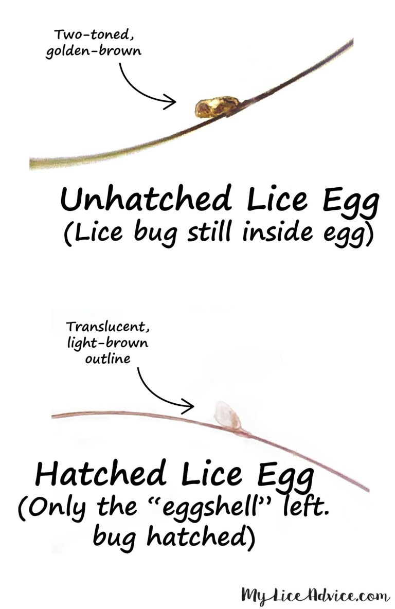 Pictures of What Lice Eggs (Nits) Look Like in Hair: 9 Tips to Spot Them