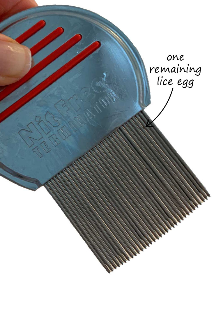 How To Clean Nit Comb - Faultconcern7