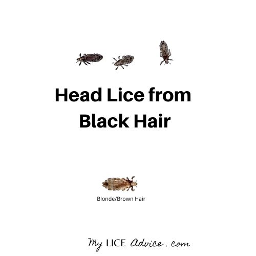 Lice In Black People Hair