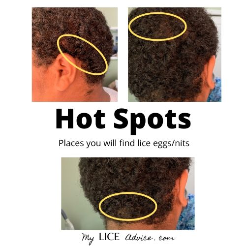 Black Children Get Lice Too Unique Challenges And Treatments [ 500 x 500 Pixel ]