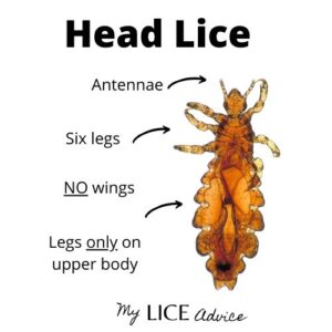 Head Lice Anatomy