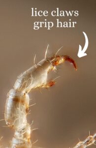 close up of claw-like feet on lice bug