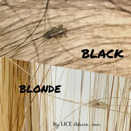 black hair vs blonde hair