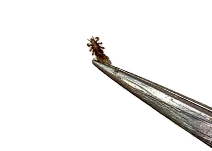 A lice bug held by tweezers