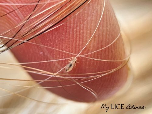 lice eggs on finger