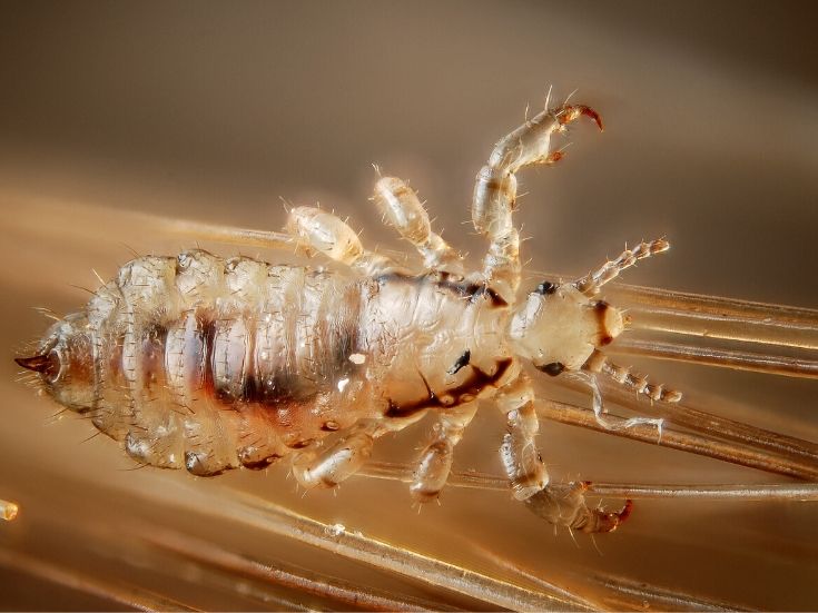 macro of lice and eggs removing by standless lice comb - Help Piojitos