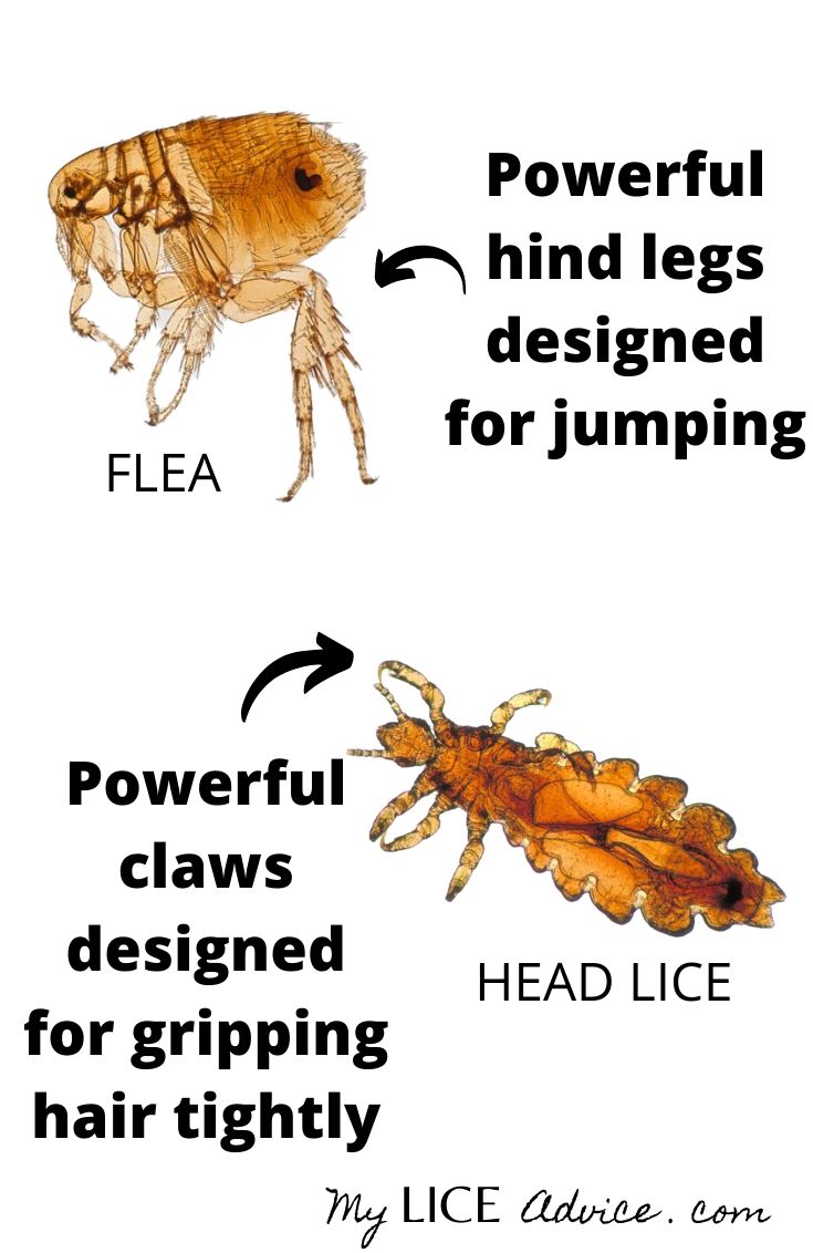 flea vs lice