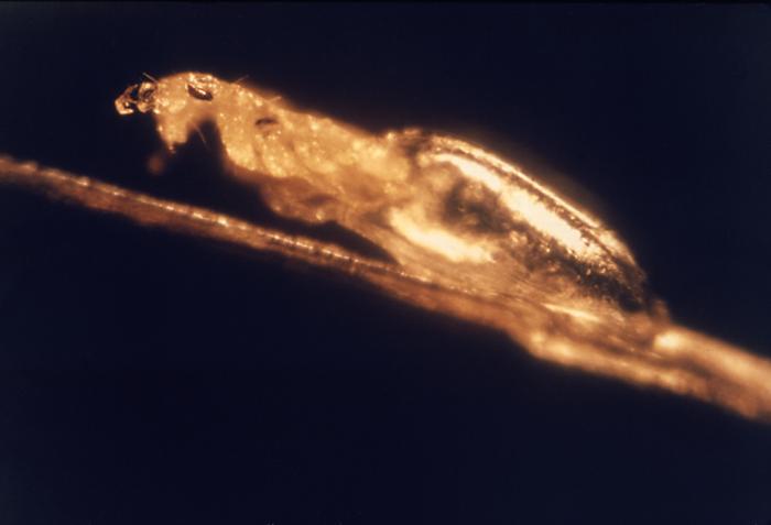 Over a black backdrop, a golden colored lice is emerging from its egg (nit). The lice egg (nit) is attached to a blond hair strand.