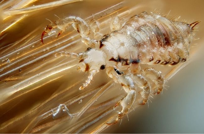 A super lice bug at high magnification.