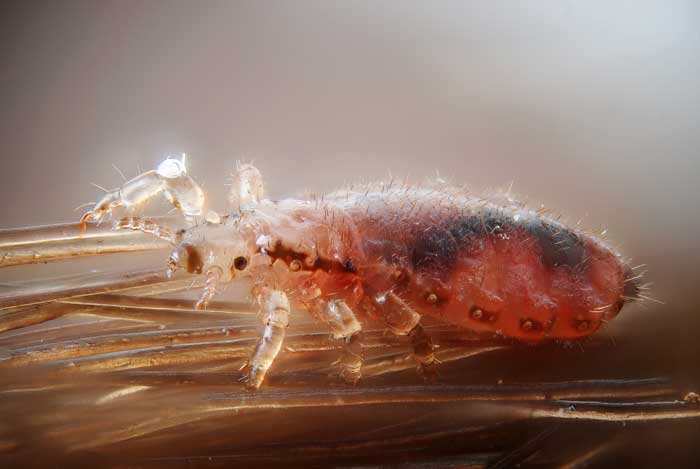 Red Lice: Why Are Some Head Lice Red? - My Lice Advice