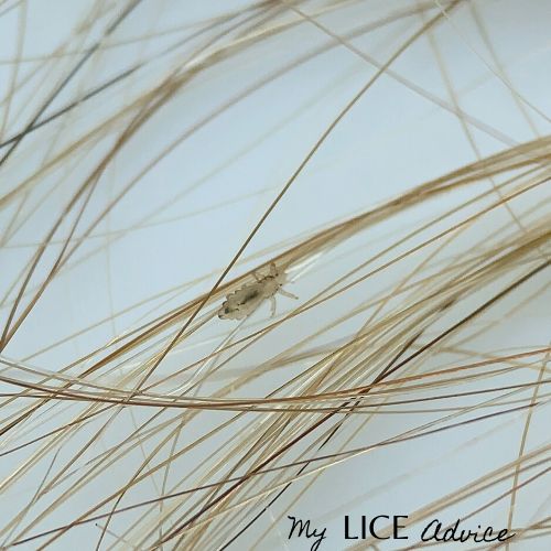 head lice eggs on blonde hair