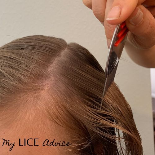 person combing through the hair wiht a lice comb that presmably has been dipped in alcohol