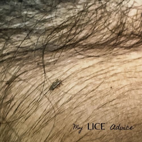 What Lice Look Like Pictures Of Lice Color Size And More   Lice Black Hair 