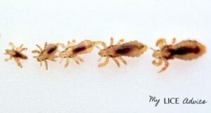 What Lice Look Like: Pictures of Lice (Color, Size, and More)