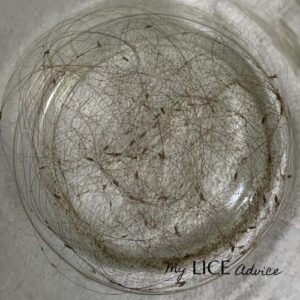 Dawn Dish Soap To Kill Lice Tutorial - My Lice Advice