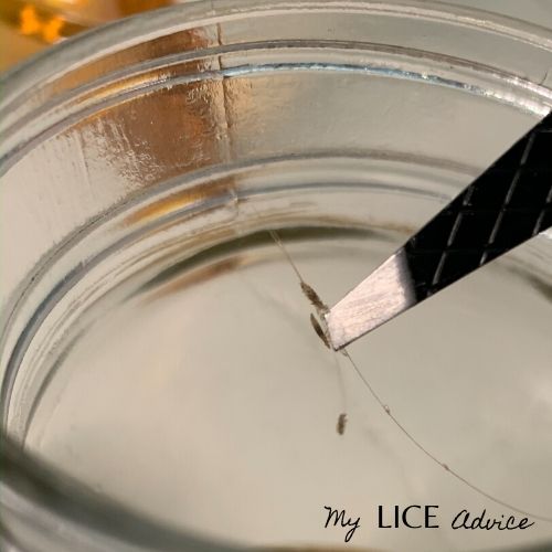 3 lice bugs being put into a jar