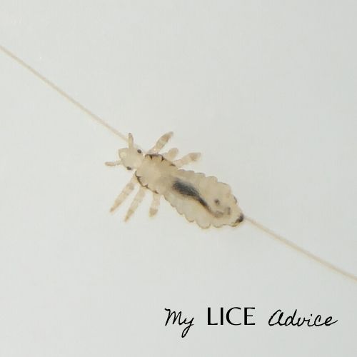 white lice bug on a single hair strand