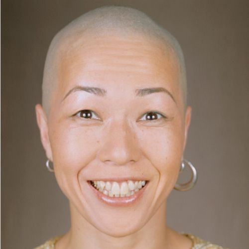 adult woman with a shaved head, presumably as a treatment for head lice