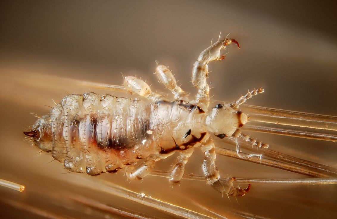 Super Lice bug with head and abdomen showing crawls along a strand of blond hair. Six legs are connected to the abdomen. The image is magnified to show the bug up close. The lice is golden translucent in color and the dark brown stomach can be seen.