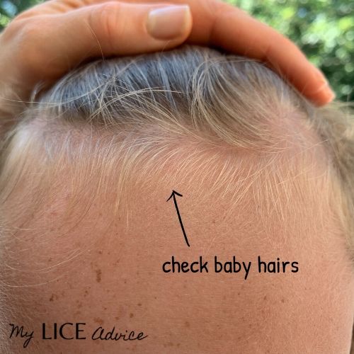 Side-by-side pictures of a girl and boys bang area baby hairs