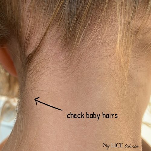 Close up of blond girls neck with two arrows pointing to baby hairs on the neck