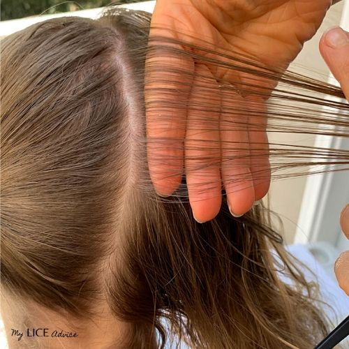 Hand placement of how to check for lice at the crown is shown on a blond girls hair.