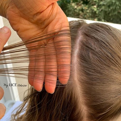 Hand placement of how to check for lice at the crown is shown on a blond girls hair.