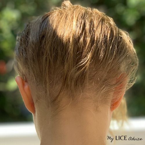 The back of a blond's head with light shining in her hair