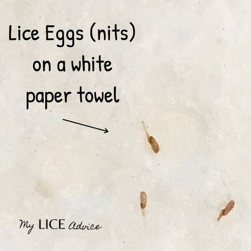 Four tear-dropped, golden-brown lice eggs (nits) are shown on a paper towel