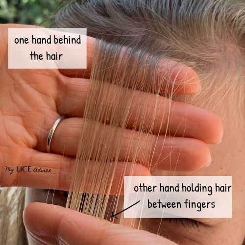 Hand placement is outlined for how to check for lice. A blond girl's bangs are check for lice