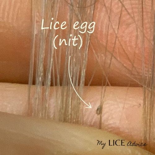 Blonde Hair And Lice A Guide to Help Parents  Licefreee