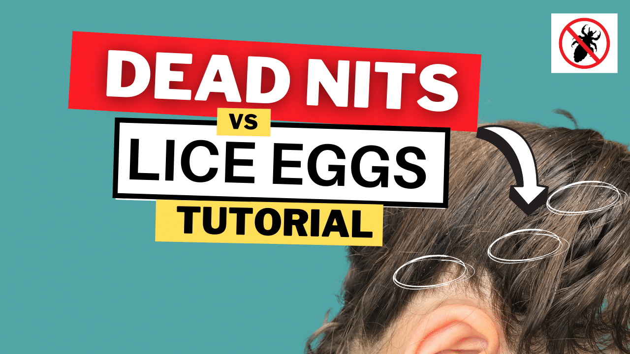 Dead Nits Vs Live Lice Eggs Video Tutorial My Lice Advice 