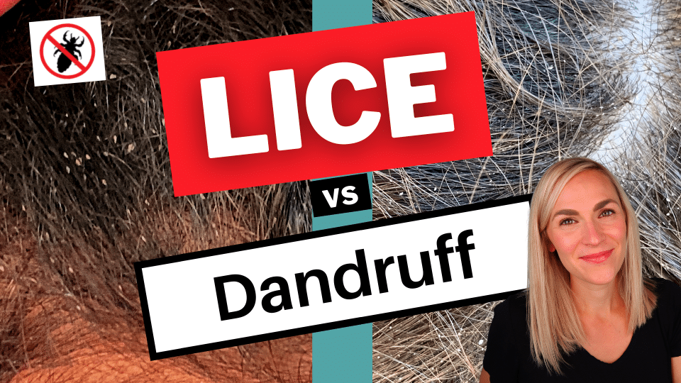 two pictures are shown side-by-side. One is of dandruff, the other is of lice eggs. Lice expert in the foreground