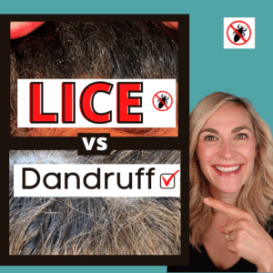 Lice vs Dandruff - 7 Key Differences Between Lice Eggs and Dandruff