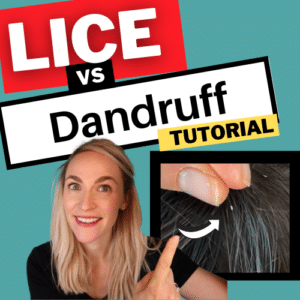 Lice vs Dandruff Video Tutorial - My Lice Advice
