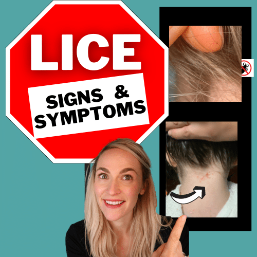 Lice Signs And Symptoms Video Tutorial My Lice Advice