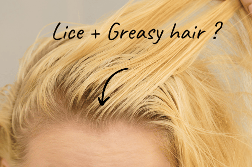 Do Lice Like Clean or Dirty Hair - My Lice Advice