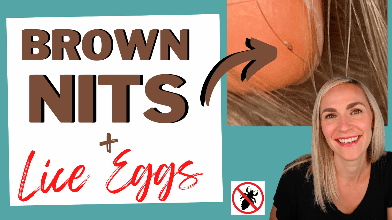 Brown Nits and Lice Eggs Thumbnail