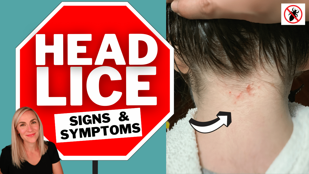 arrow pointing to the symptom of lice bites on the back of the neck. Lice expert with a stop sign that says, "head lice signs & symptoms"