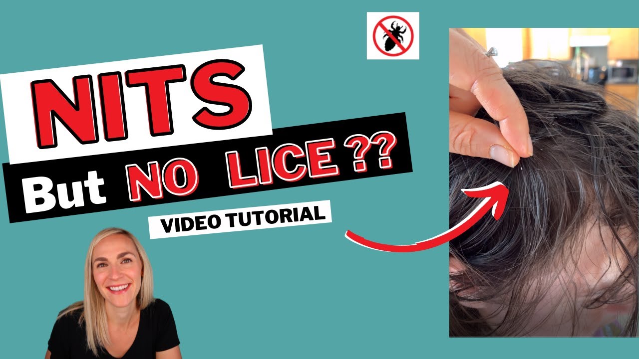 arrow pointing to a nit (lice egg) in hair. Lice expert in the picture. The words "Nits but no lice?"
