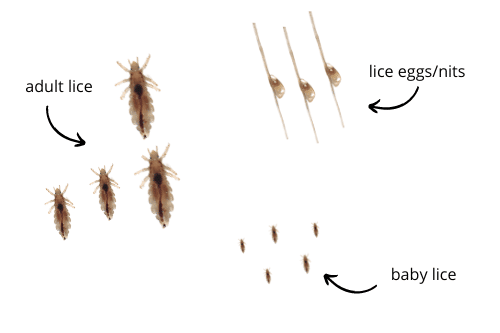 lice eggs, baby lice, and adult lice with arrows labeling them