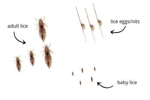 Will Alcohol Kill Lice Eggs?